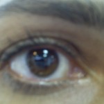 My eye picture